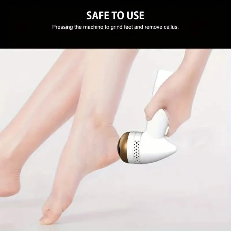 Máquina eléctrica de pedicura para pies con aspirador, removedor de callos y piel muerta, cuidado de los pies